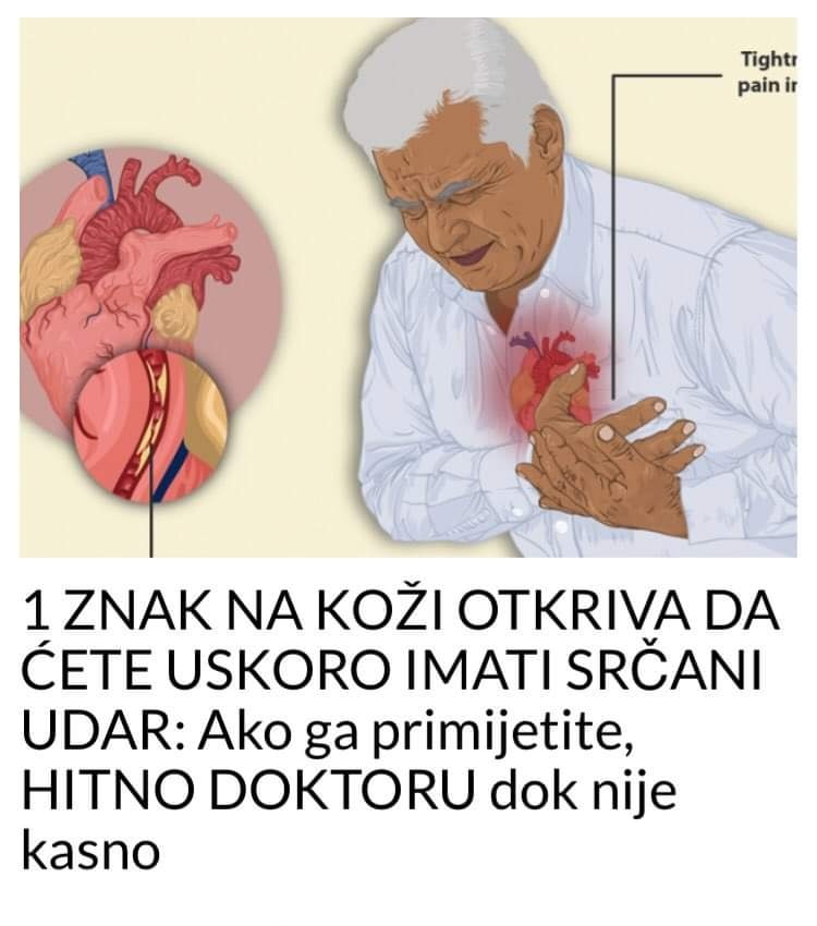 Znakovi srčanog udara