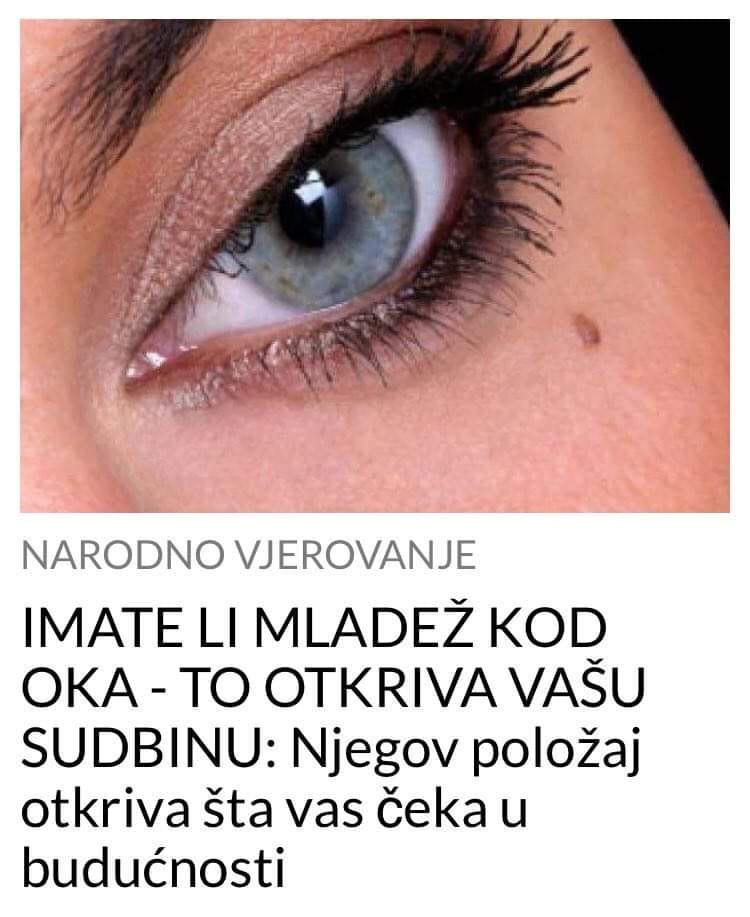 AK IMATE MLADEŽ KOD OKA POGLEDAJTE KOJE JE TO ZNAČENJE