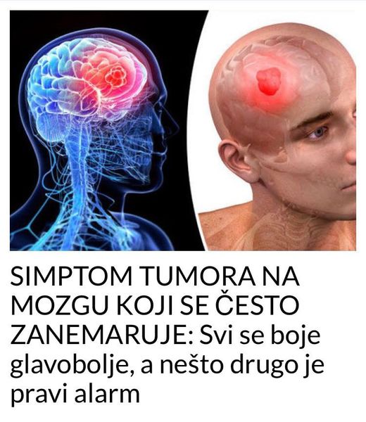 POGLEDAJTE KOJI JE TO SIMPTOM TUMORA MOZGA KOJI SE CESTO ZANEMARI