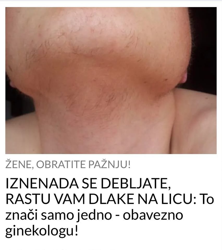 AKO STE PRIMJETILE DLAKE NA LICU I IZNENADNO DEBLJANJE, ODMAH GINEKOLOGU JER OVO JE RAZLOG