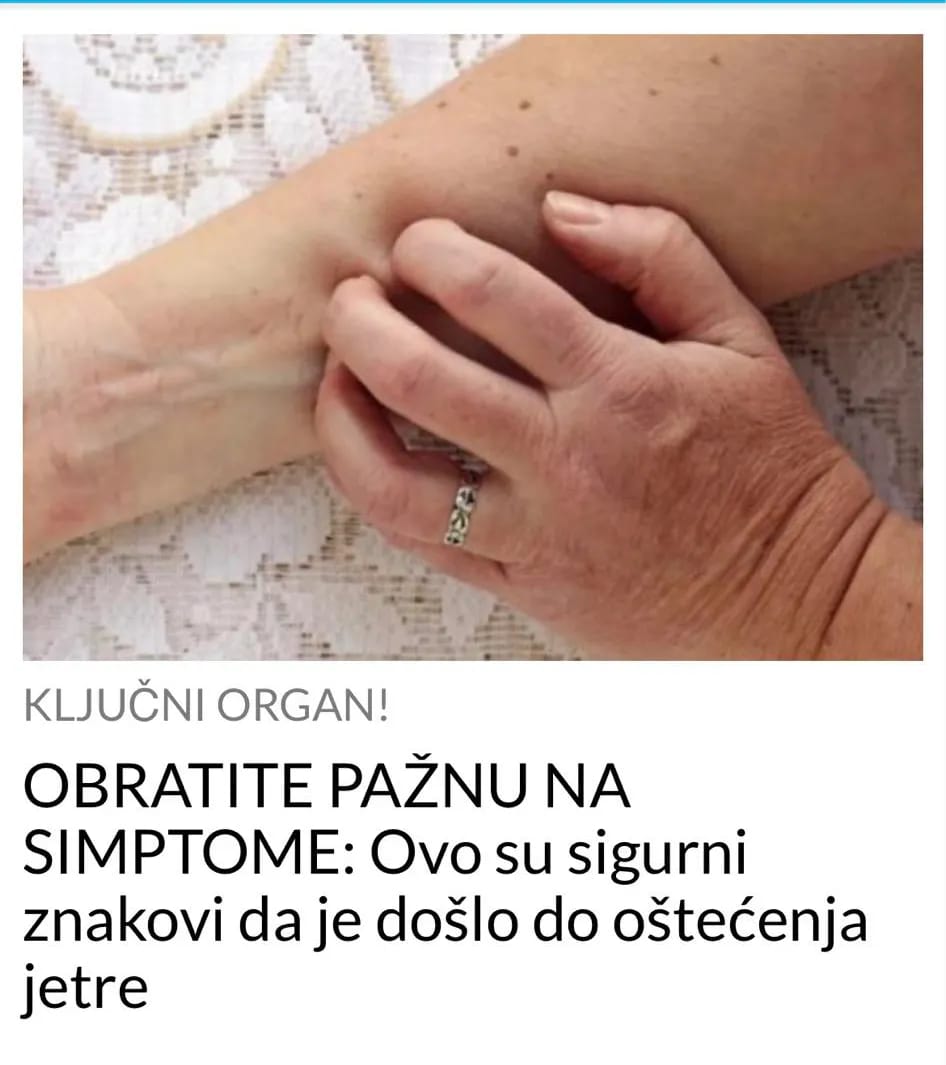 AKO IMATE OVE SIMPTOME ODMAH POTRAZITE POMOC LJEKARA,VASA JETRA JE U PITANJU