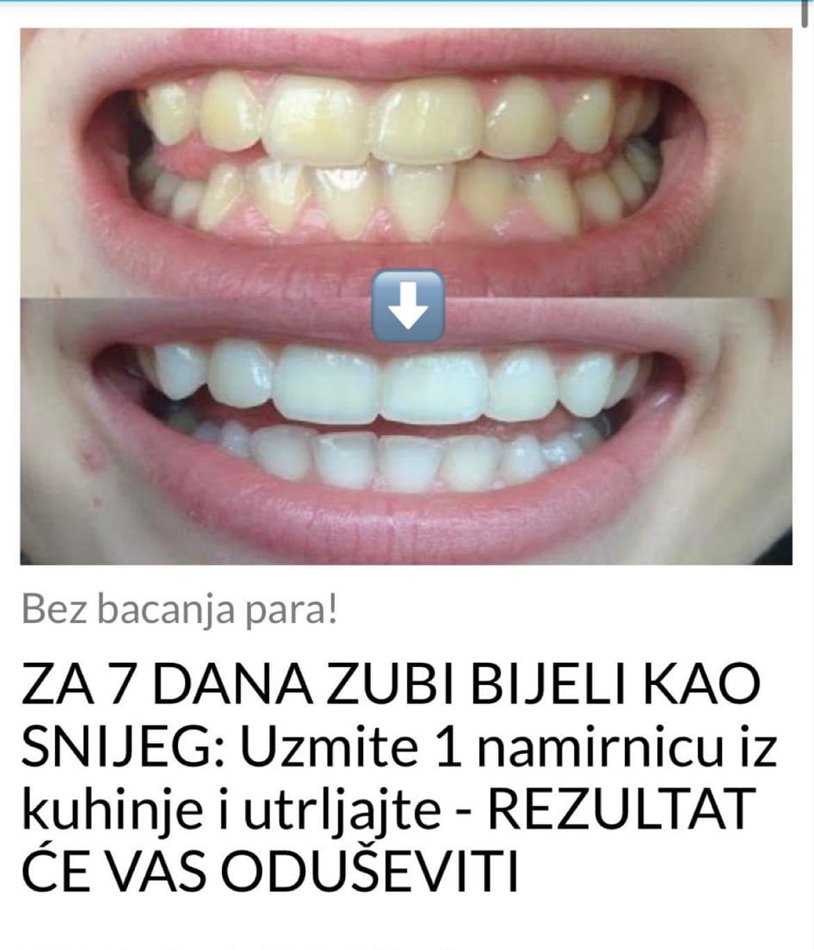 IZBIJELITE ZUBE ZA SAMO 7 DANA SA OVOM NAMIRNICOM