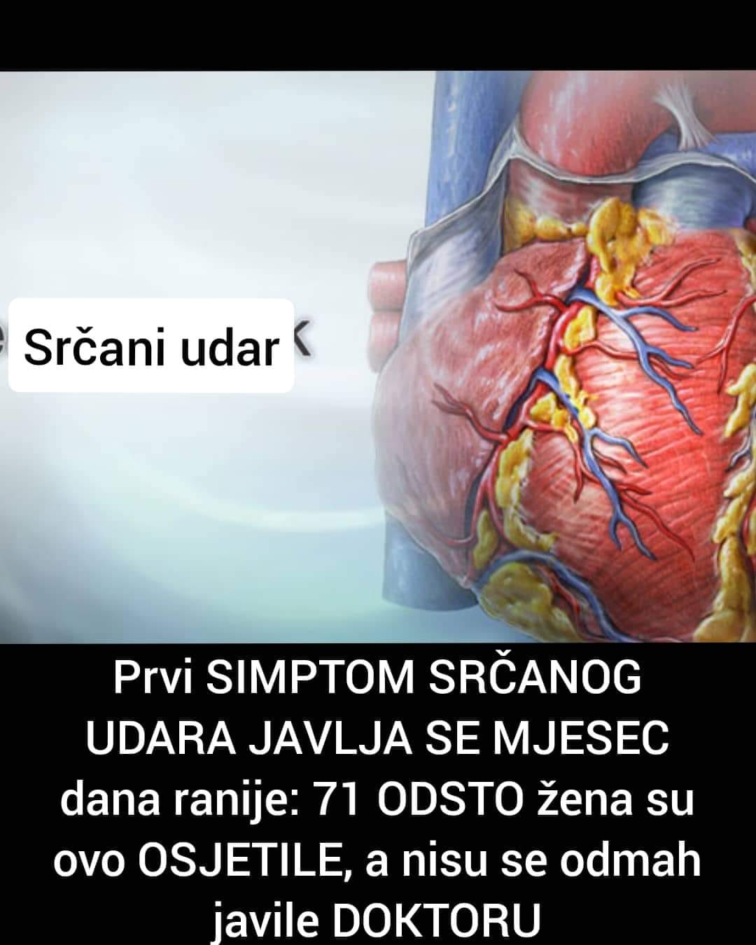 SIMPTOMI SRCANOG UDARA KOJI SE JAVLJAJU MJESEC DANA RANIJE