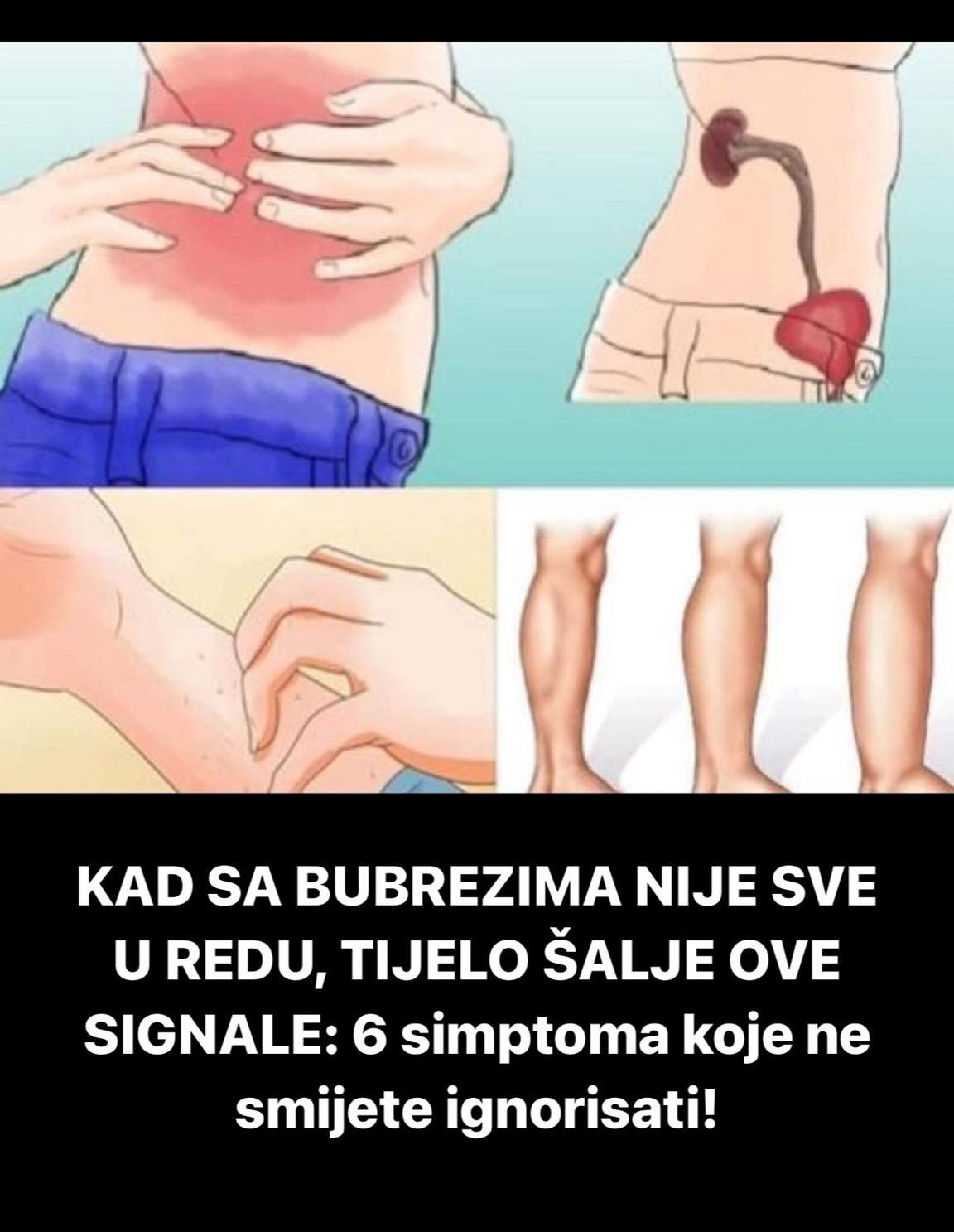 POGLEDAJTE KOJI SU SIMPTOMI OBOLJENJA BUBREGA NA KOJE NAM TIJELO UKAZUJE