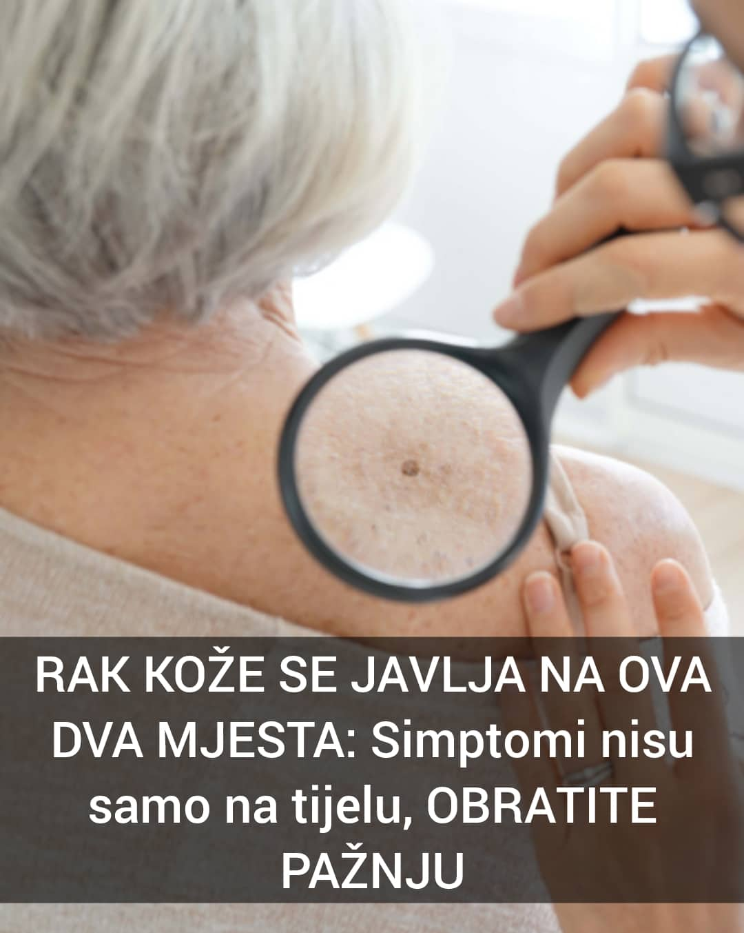 POGLEDAJTE NA KOJA 2 MJESTA SE JAVLJA RAK KOZE