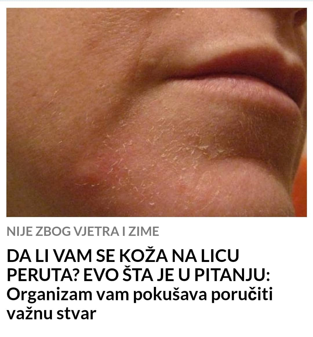 POGLEDAJTE ZAŠTO VAM SE KOŽA NA LICU PERUTA