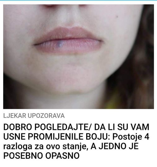 AKO VAM USNE MIJENJAJU BOJU TREBATE OBRATITI PAZNJU, MOZE BITI VEOMA OPASNO!