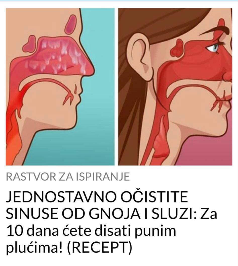 POGLEDAJTE KAKO DA JEDNOSTAVNO OČISTITE SINUSE OD GNOJA I SLUZI