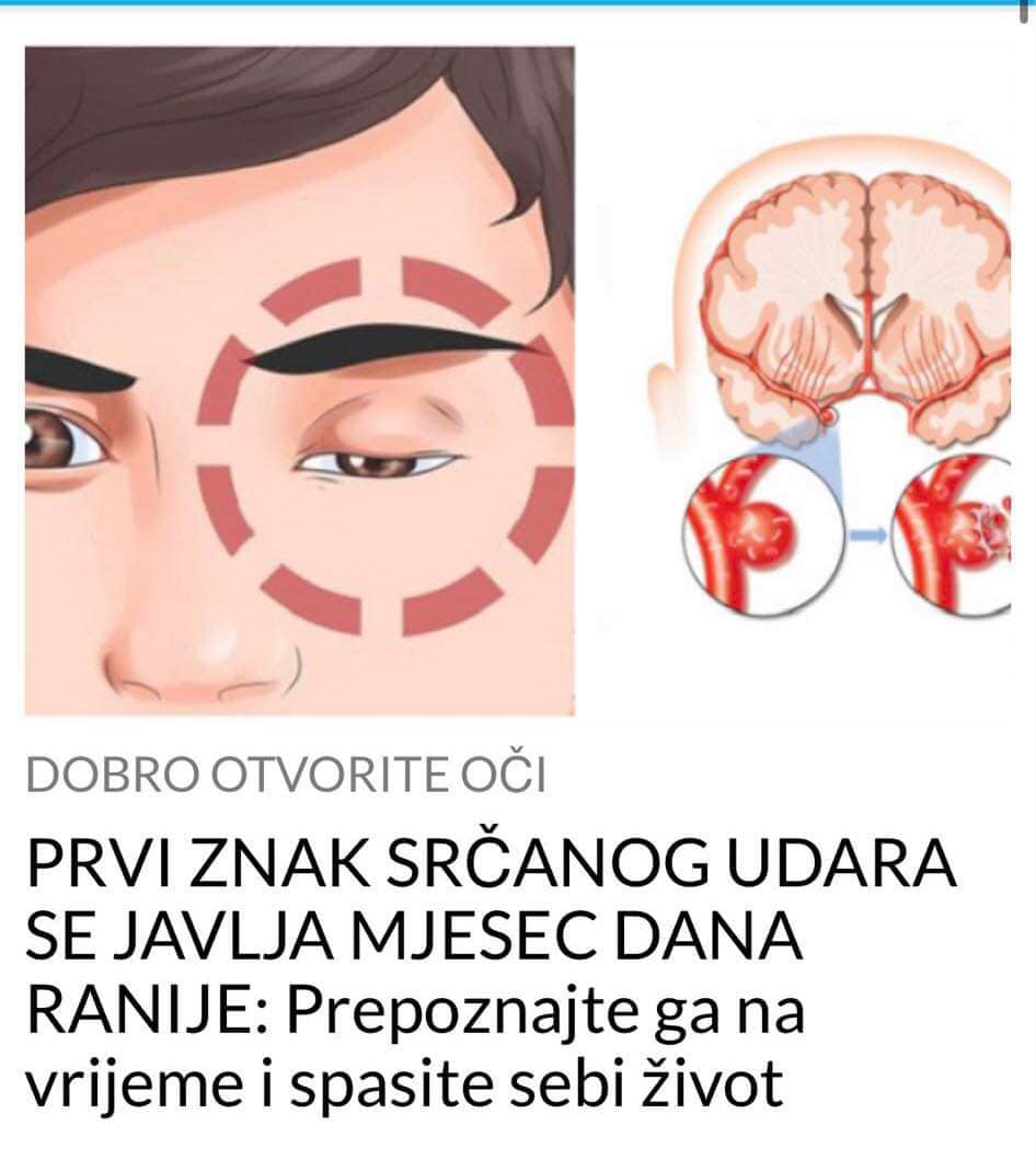 PREPOZNAJTE ZNAKE SRCANOG UDARA PRIJE NA MJESEC DANA