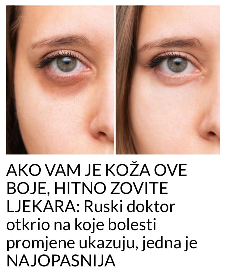 BOJA VASE KOZE POKAZUJE VAM OD CEGA BOLUJETE