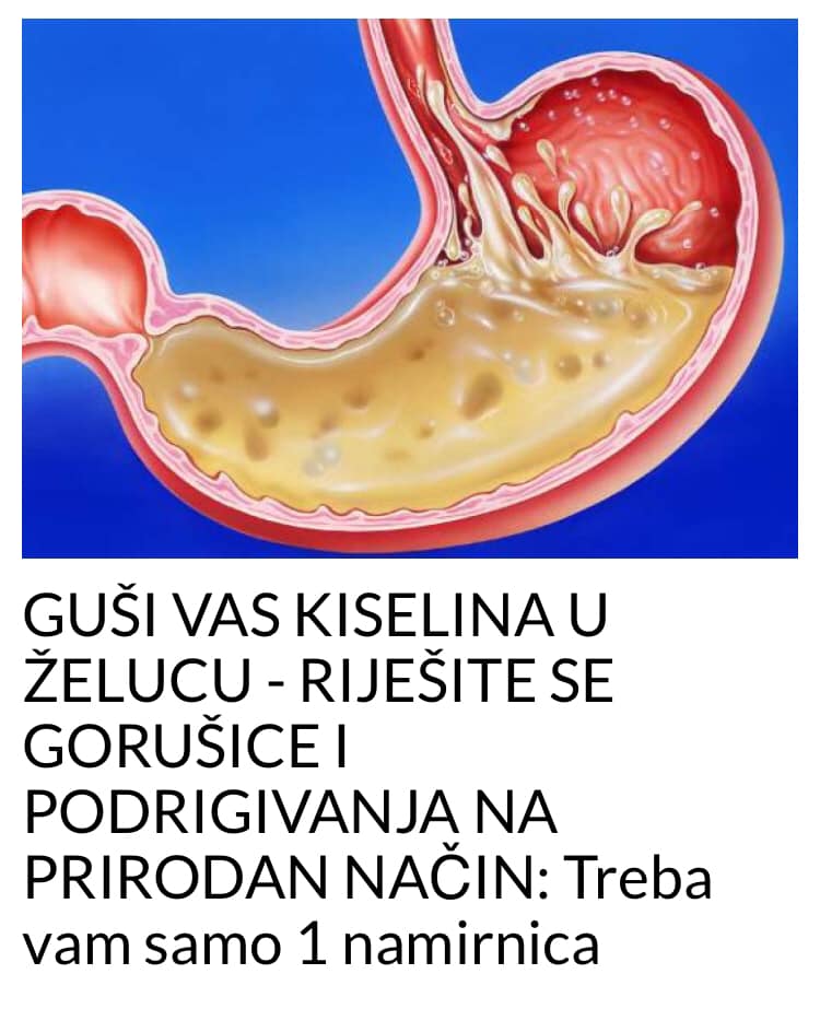 GUŠI VAS KISELINA U ŽELUCU – RIJEŠITE SE GORUŠICE I PODRIGIVANJA NA PRIRODAN NAČIN: