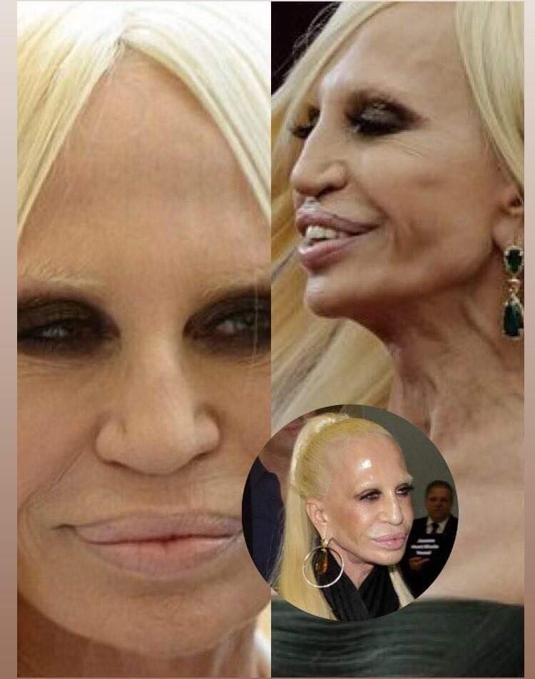 POGLEDAJTE UNAKAZENO LICE DONATELLA VERSACE