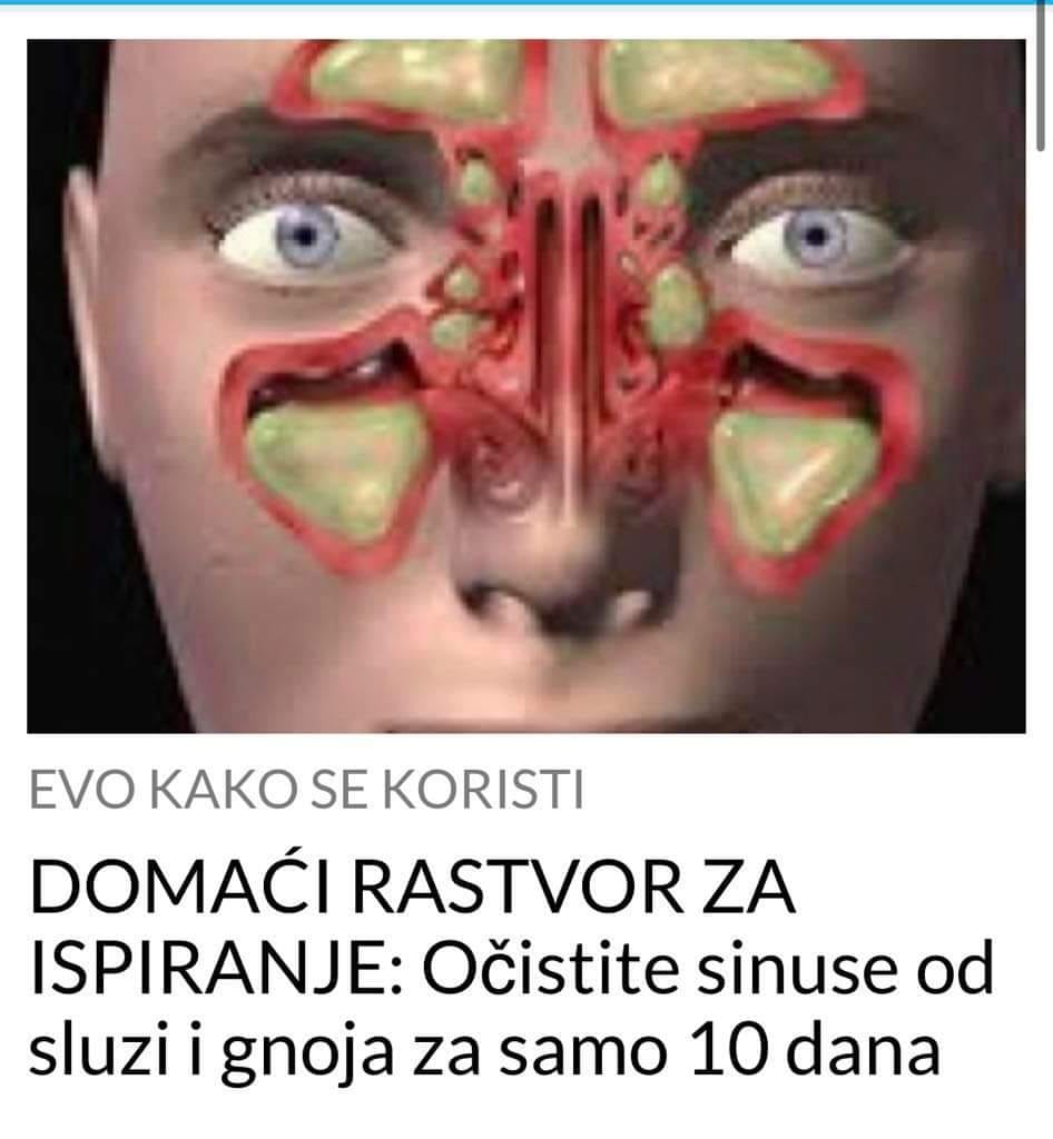 POGLEDAJTE KAKO DA OČISTITE SINUSE