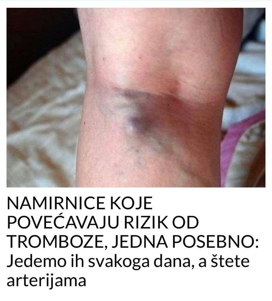 POGLEDAJTE KOJE NAMIRNICE POVECAVAJU RIZIK OD TROMBOZE