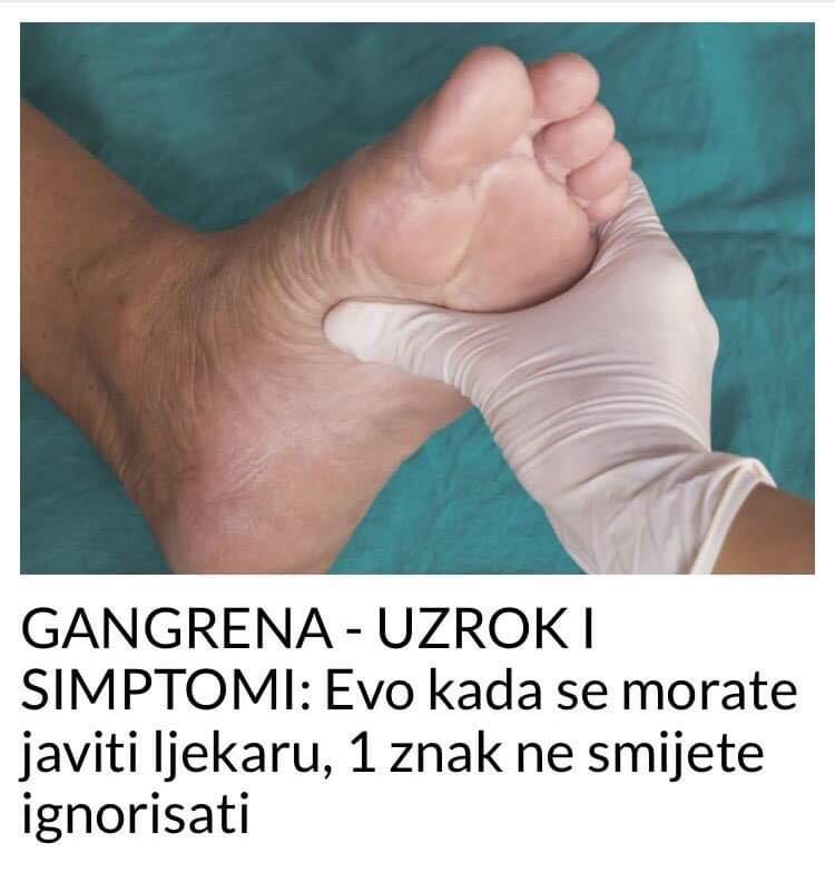 UZROK I SIMPTOMI GANGRENE