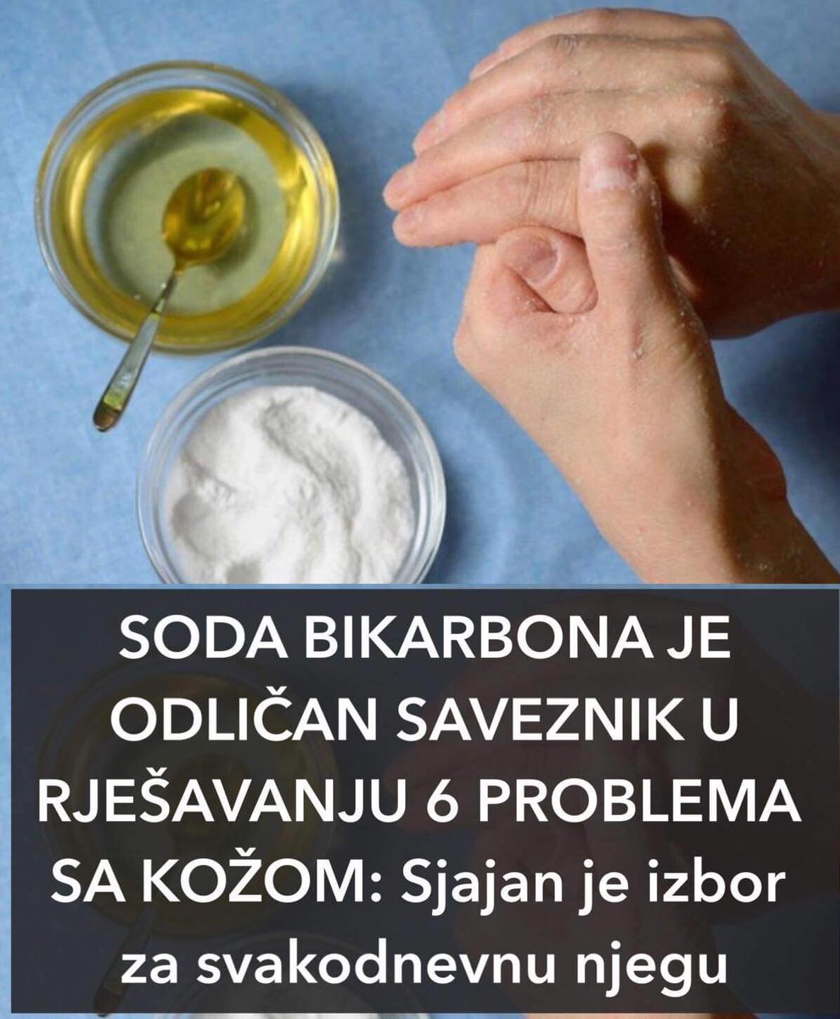 POGLEDAJTE ZA KOJIH 6 PROBLEMA SA KOZOM  JE SODA BIKARBONA ODLICAN SAVEZNIK