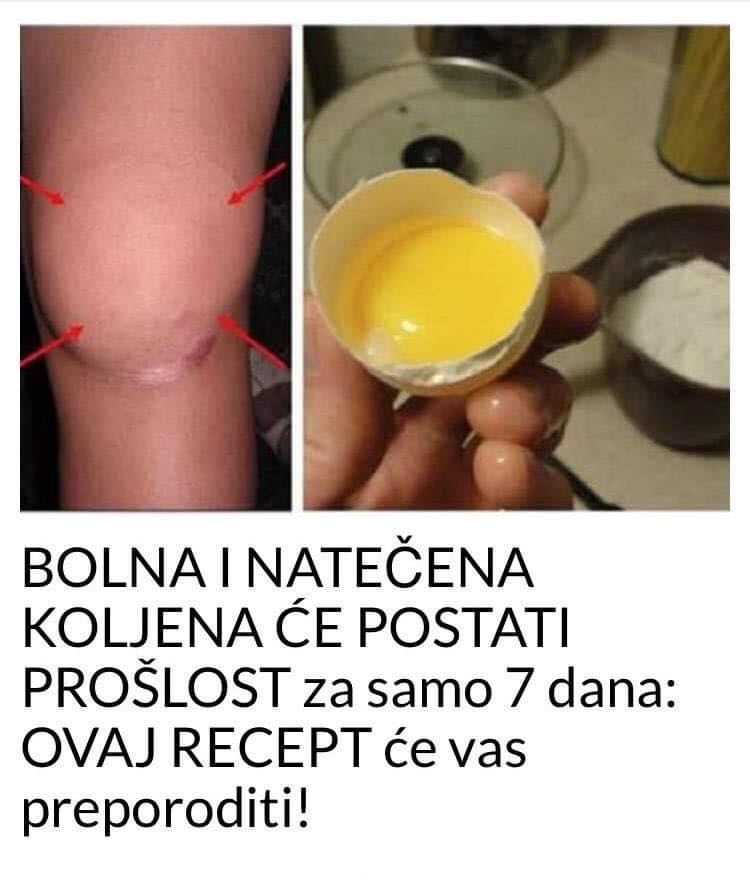 POGLEDAJTE KAKO DA NAPRAVITE LIJEK ZA BOLNA I OTECENA KOLJENA