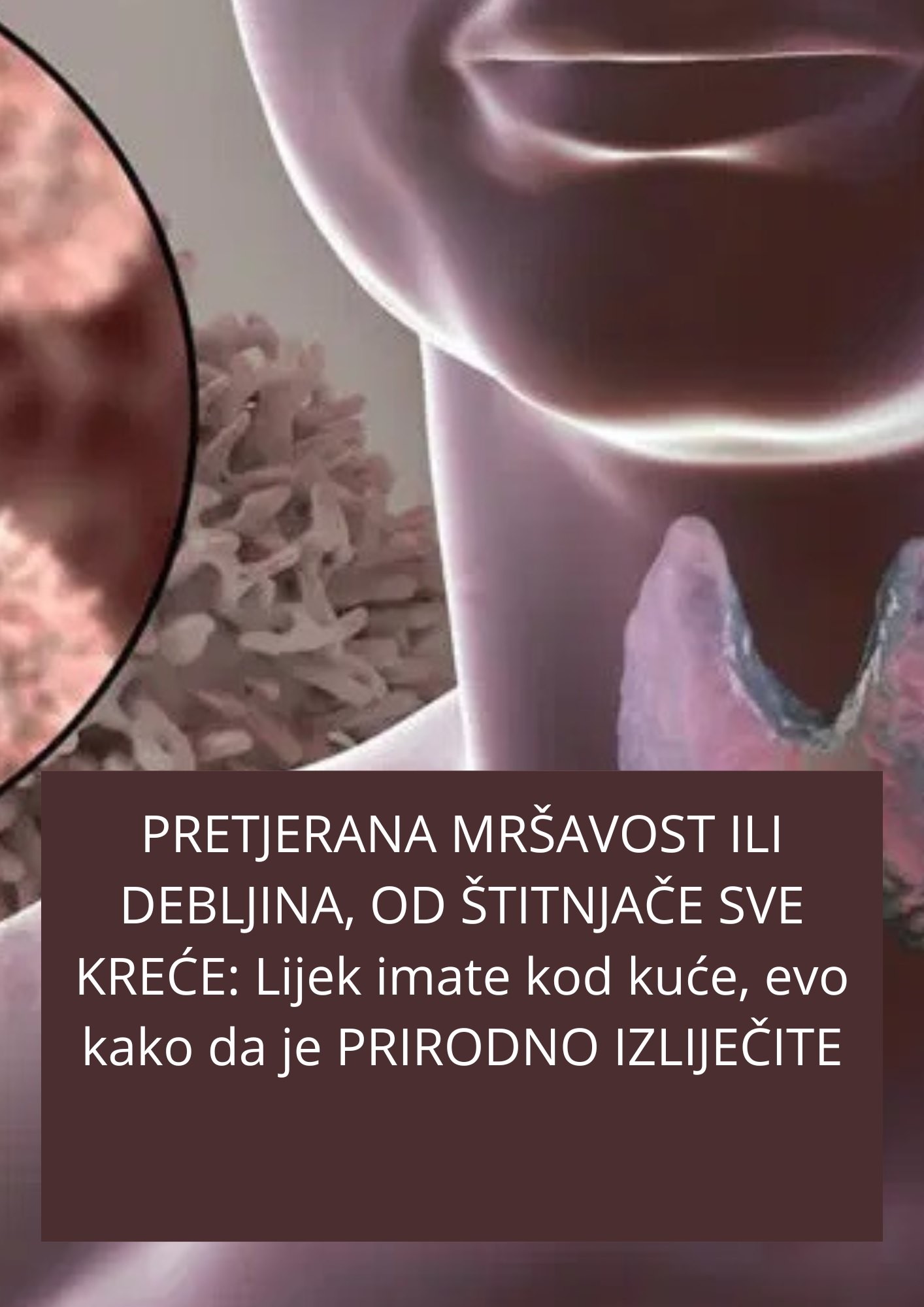 evo kako da  PRIRODNO IZLIJEČITE STITNJACU