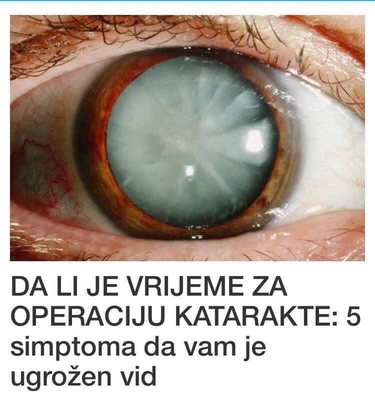 DA LI JE VRIJEME ZA OPERACIJU KATARAKTE: