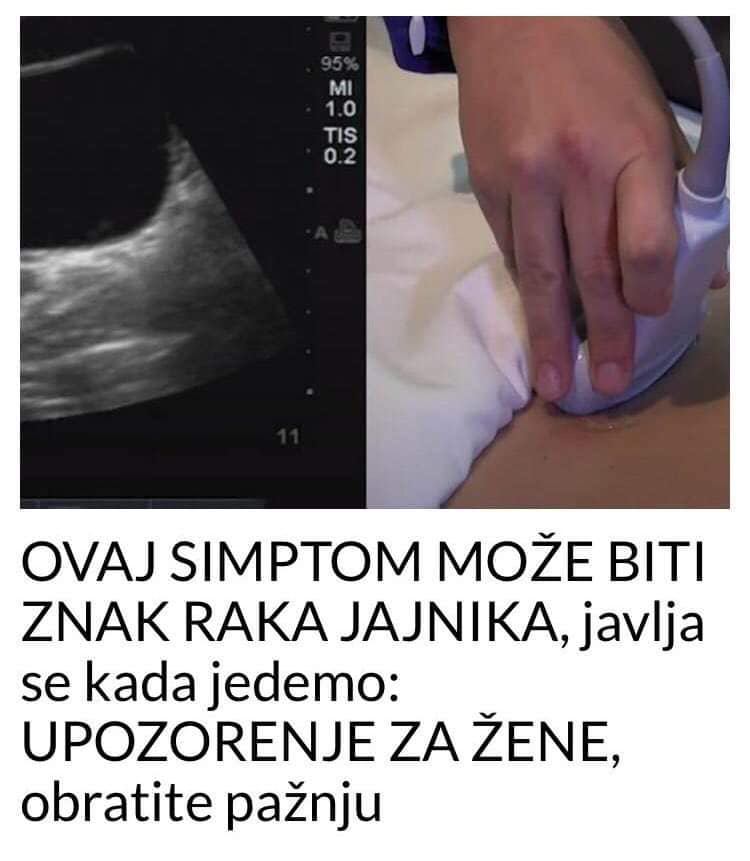 POGLEDAJTE KOJI SIMPTOM MOŽE BITI ZNAK RAKA JAJNIKA