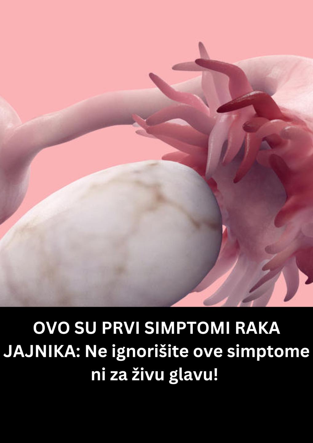 OVO SU PRVI SIMPTOMI RAKA JAJNIKA: