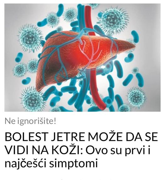 POGLEDAJTE KAKO NAJLAKSE OTKRITI BOLEST JETRE !