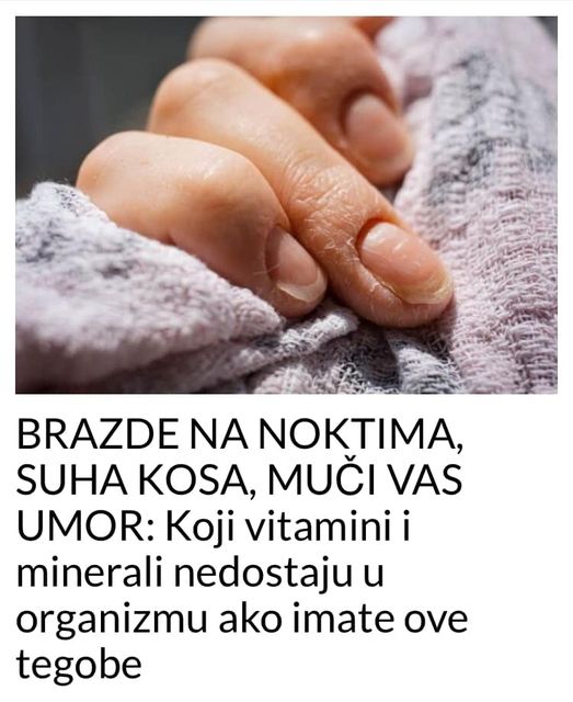 SAZNAJTE KOJI VITAMIN VAM NEDOSTAJE !