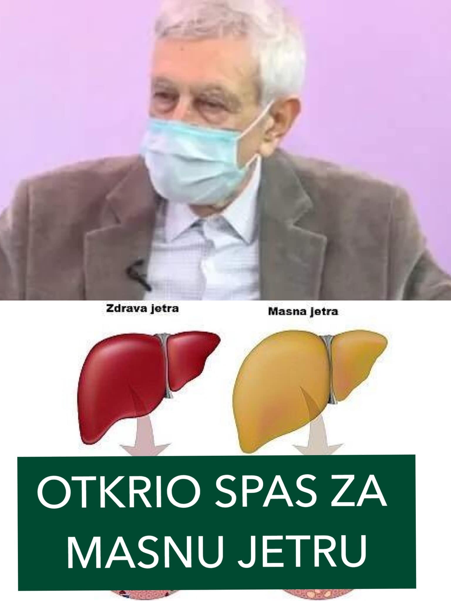 POGLEDAJTE KAKO SPASITI MASNU JETRU