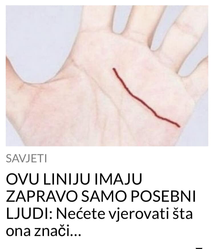 POGLEDAJTE STA IMAJU POSEBNI LJUDI