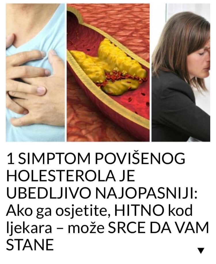 EVO KOJI JE PRVI SIMPTOM POVIŠENOG HOLESTEROLA