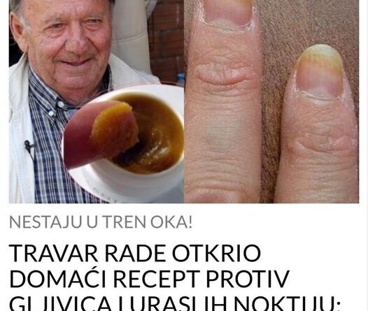 POGLEDAJTE TRAVAR RADE OTKRIO DOMAĆI RECEPT PROTIV GLJIVICA I URASLIH NOKTIJU: Trebaju vam samo 3 sastojka