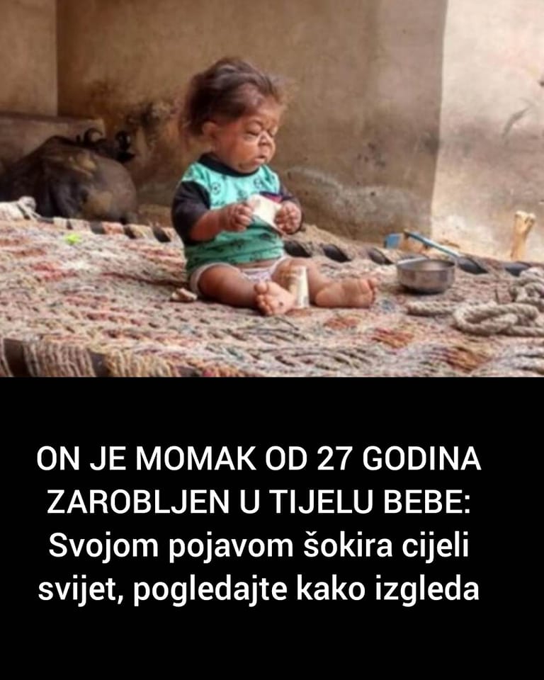 POGLEDAJTE KAKO IZGLEDA MOMAK OD 27 GODINA ZAROBLJEN U TIJELU BEBE