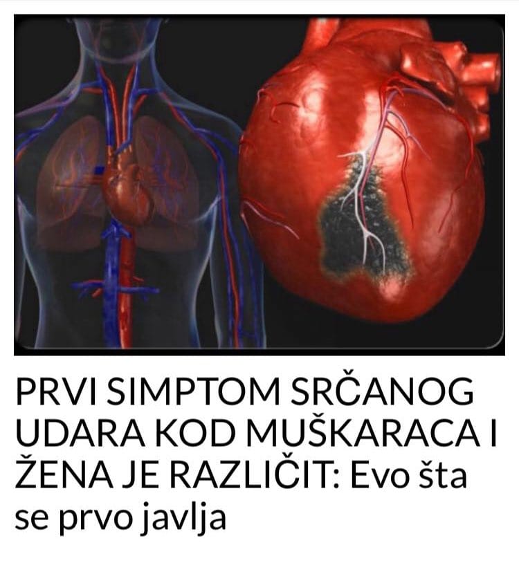 PRVI SIMPTOM SRČANOG UDARA KOD MUŠKARACA I ŽENA JE RAZLIČIT