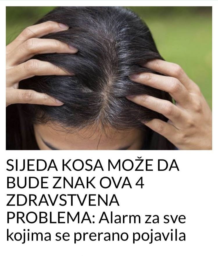 POGLEDAJTE KAKO SIJEDA KOSA MOŽE DA BUDE ZNAK OVA 4 ZDRAVSTVENA PROBLEMA