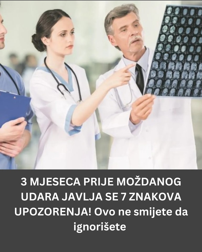 POGLEDAJTE 7 ZNAKOVA UPOZORENJA MOŽDANOG UDARA