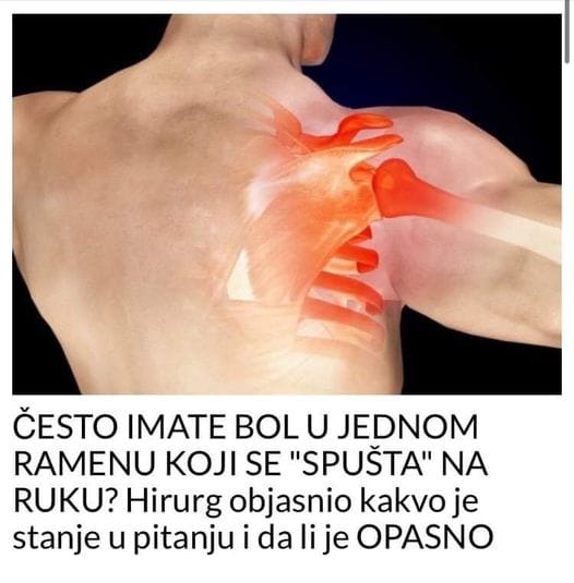 POGLEDAJTE ŠTA ZNAČI KADA IMATE BOL U JEDNOM RAMENU KOJI VAM SE SPUŠTA NIZ RUKU