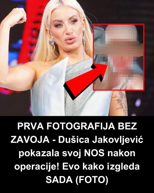 PRVA FOTOGRAFIJA BEZ ZAVOJA – Dušica Jakovljević pokazala svoj NOS nakon operacije! Evo kako izgleda SADA (FOTO)