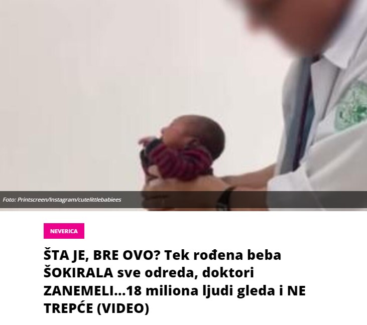 ŠTA JE, BRE OVO? Tek rođena beba ŠOKIRALA sve odreda, doktori ZANEMELI…18 miliona ljudi gleda i NE TREPĆE (VIDEO)