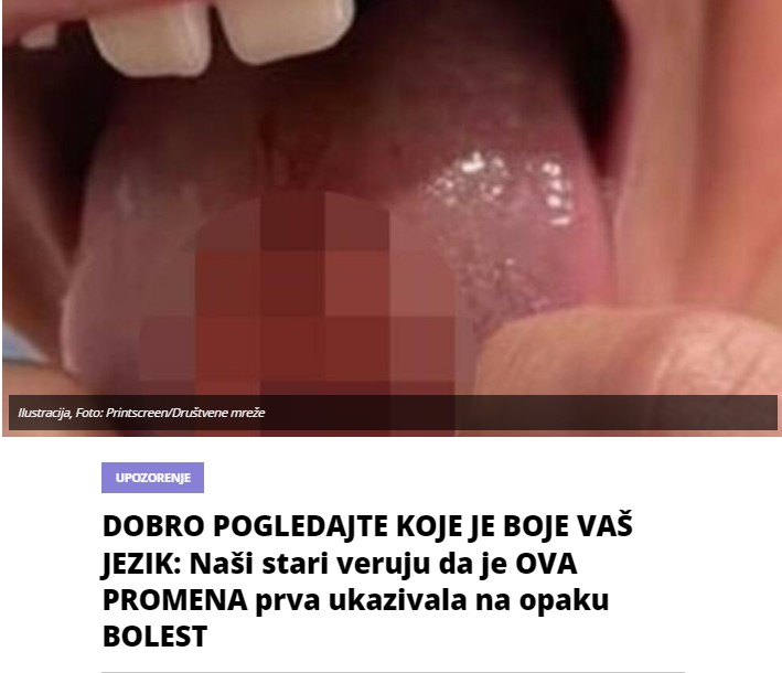 DOBRO POGLEDAJTE KOJE JE BOJE VAŠ JEZIK: Naši stari veruju da je OVA PROMENA prva ukazivala na opaku BOLEST