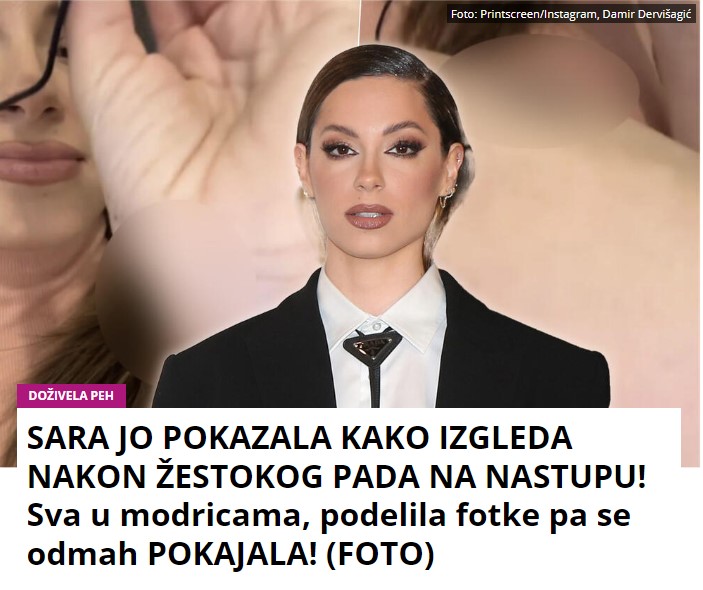 SARA JO POKAZALA KAKO IZGLEDA NAKON ŽESTOKOG PADA NA NASTUPU! Sva u modricama, podelila fotke pa se odmah POKAJALA! (FOTO)