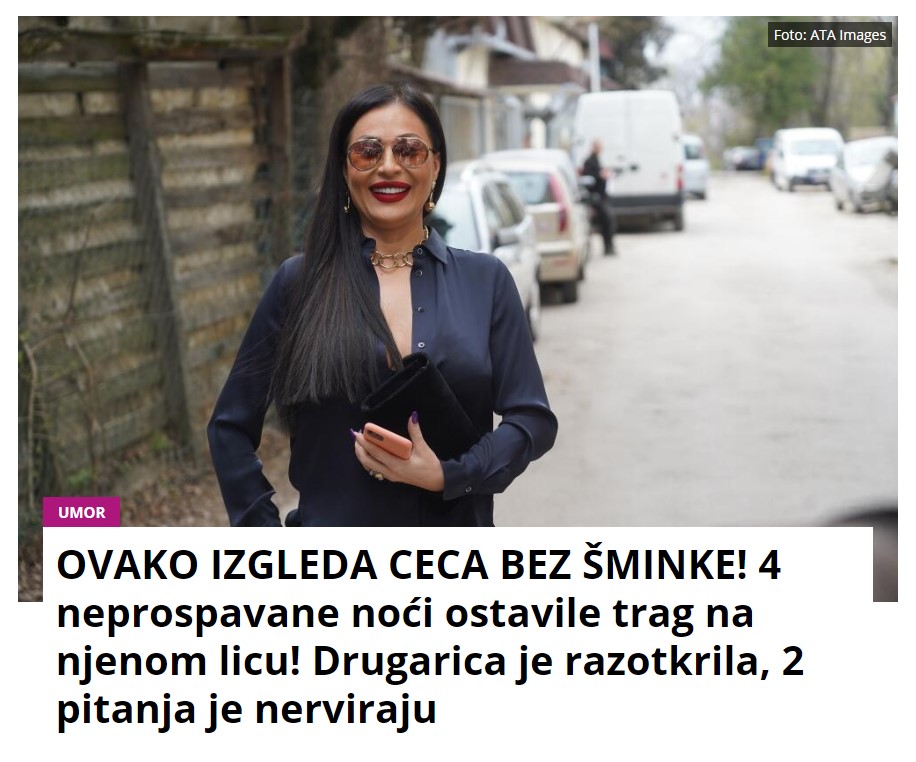 OVAKO IZGLEDA CECA BEZ ŠMINKE! 4 neprospavane noći ostavile trag na njenom licu! Drugarica je razotkrila, 2 pitanja je nerviraju