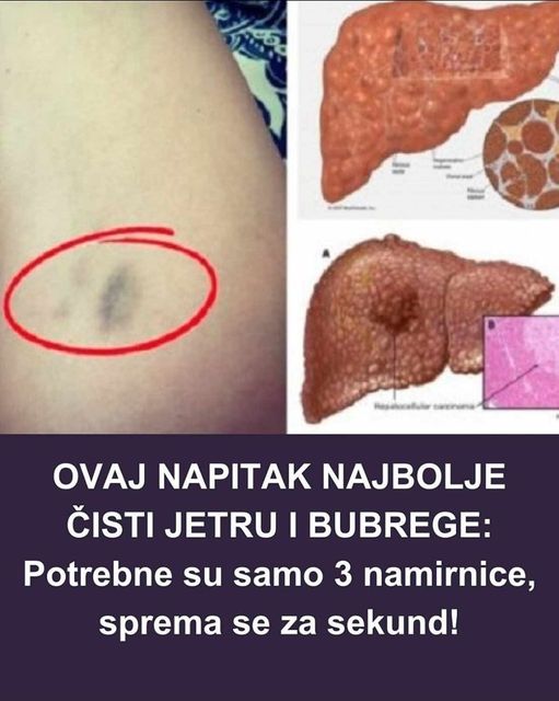 0VAJ NAPITAK NAJBOLJE ČISTI JETRU I BUBREGE: Potrebne Su Samo 3 Namirnice, Sprema Se Za Sekund!