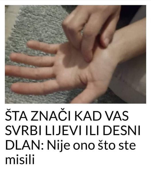 ŠTA ZNAČI KAD VAS SVRBI LIJEVI ILI DESNI DLAN: Sljedeći put ćete makar znati ŠTA VAS ČEKA!