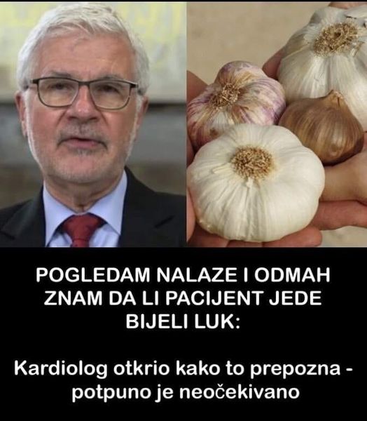 POGLEDAM NALAZE I ODMAH ZNAM DA LI PACIJENT JEDE BIJELI LUK: Kardiolog otkrio kako to prepozna – potpuno je neočekivano