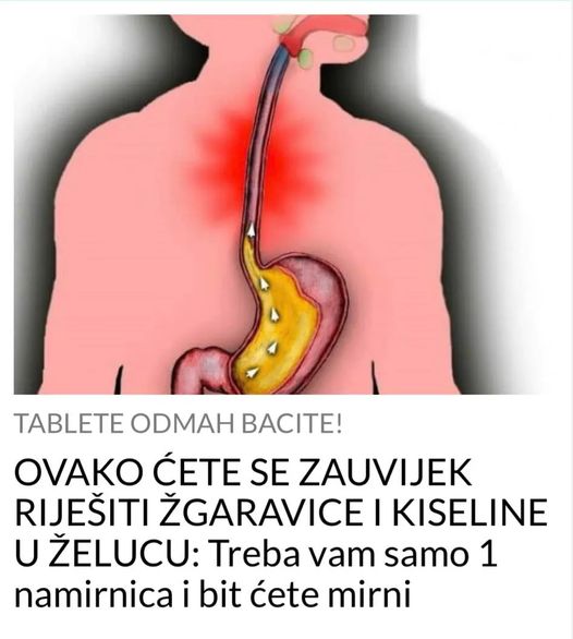 OVAKO ĆETE SE ZAUVIJEK RIJEŠITI ŽGARAVICE I KISELINE U ŽELUCU: Treba vam samo 1 namirnica i bit ćete mirni