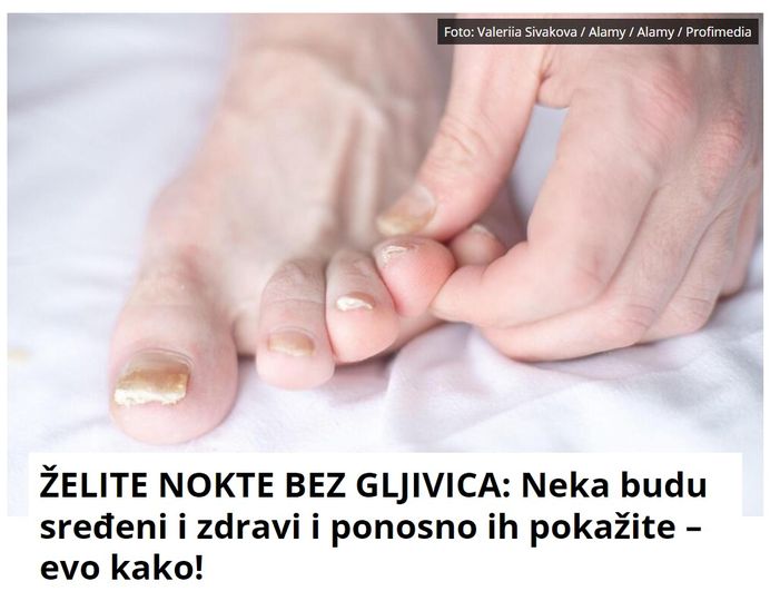 ŽELITE NOKTE BEZ GLJIVICA: Neka budu sređeni i zdravi i ponosno ih pokažite – evo kako!