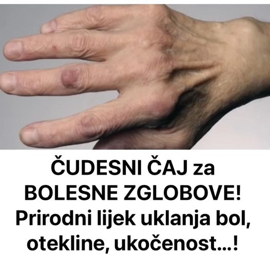 ČUDESNI ČAJ za BOLESNE ZGLOBOVE! Prirodni lijek uklanja bol, otekline, ukočenost…!