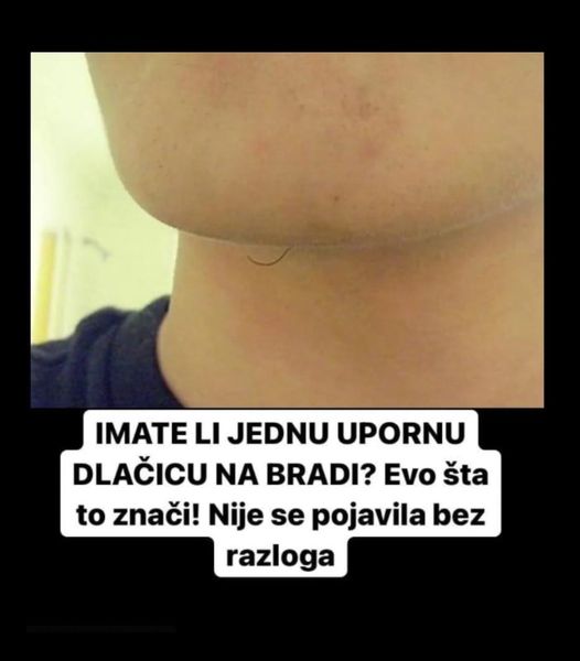 IMATE LI JEDNU UPORNU DLAČICU NA BRADI? Evo šta to znači! Nije se pojavila bez razloga