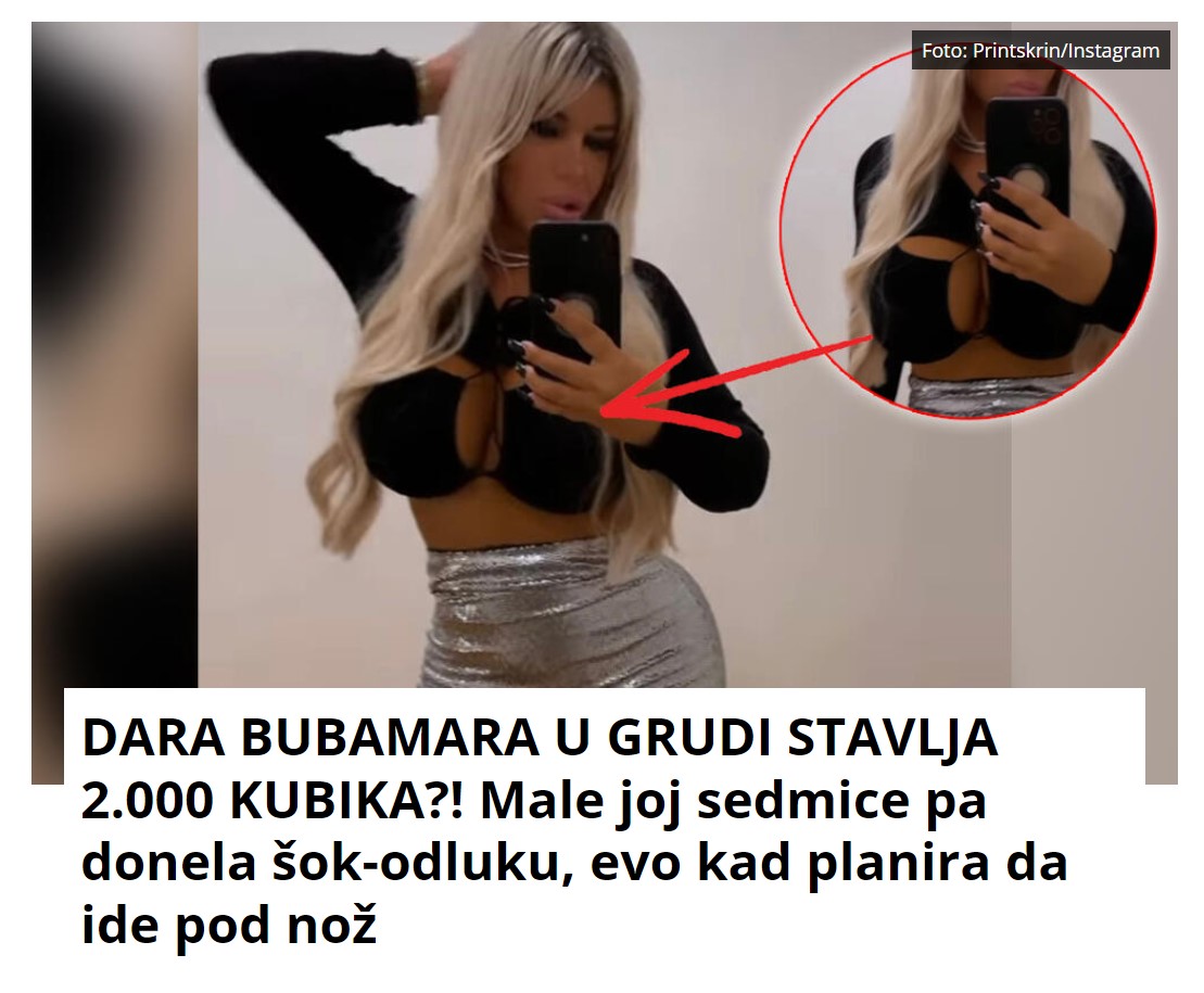 DARA BUBAMARA U GRUDI STAVLJA 2.000 KUBIKA?! Male joj sedmice pa donela šok-odluku, evo kad planira da ide pod nož