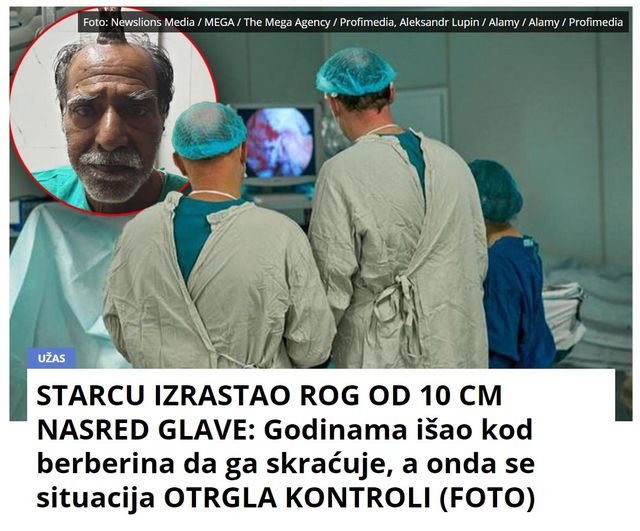 STARCU IZRASTAO ROG OD 10 CM NASRED GLAVE: Godinama išao kod berberina da ga skraćuje, a onda se situacija OTRGLA KONTROLI (FOTO)